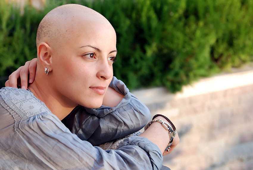Chemo Hair Loss