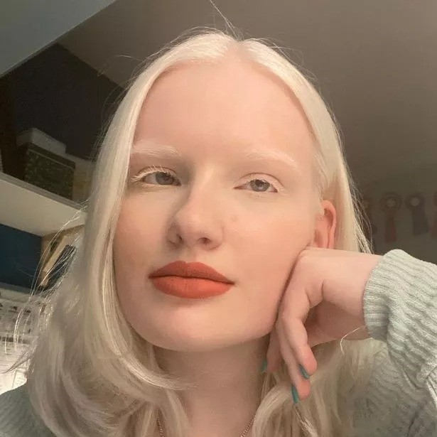 can albino people dye their hair