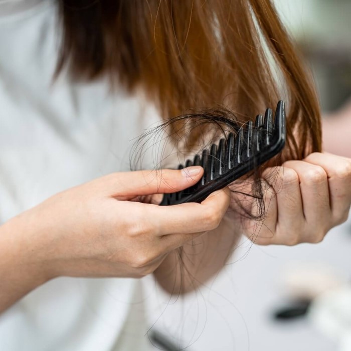 accutane hair loss treatment